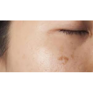 Créme de soin tâches brunes